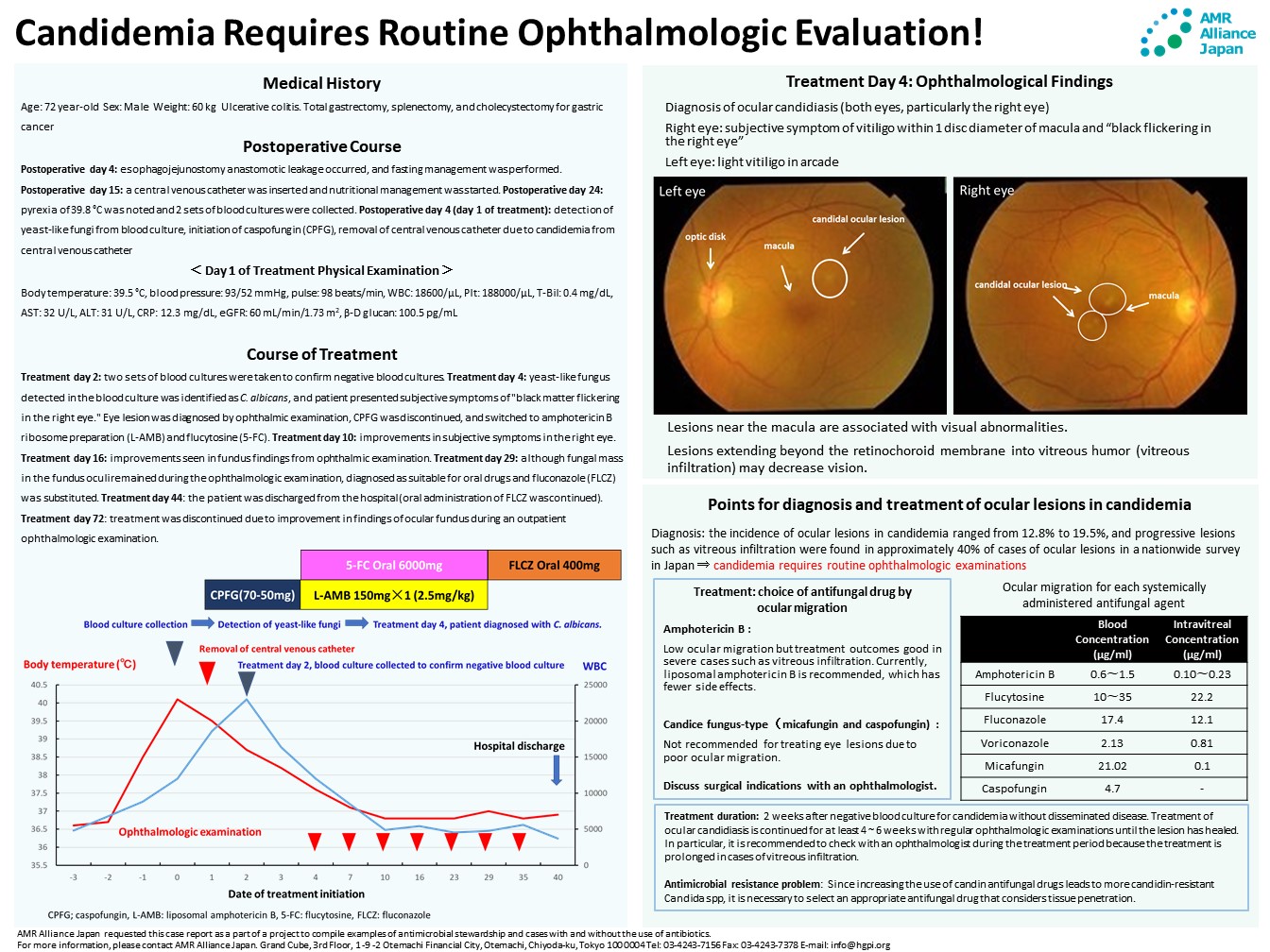 [Case Study] Takashi Ueda “Candidemia Requires Routine Ophthalmologic Evaluation!” (AMR Alliance Japan, November 18, 2021)
