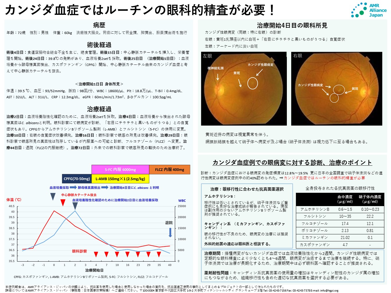 【症例報告】植田貴史「カンジダ血症ではルーチンの眼科的精査が必要！」（AMRアライアンス・ジャパン、2021年11月18日）